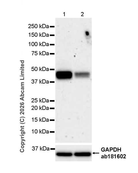 Western blot - Anti-TMEM175 antibody [RM1351] (AB325021)