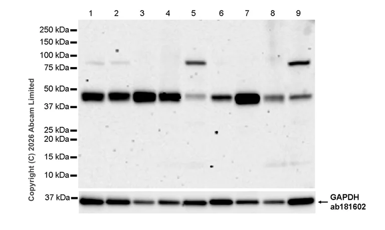 Western blot - Anti-TMEM175 antibody [RM1351] (AB325021)