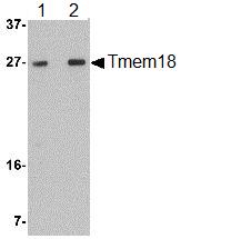 Western blot - Anti-Tmem18 antibody (AB106597)