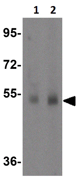 Western blot - Anti-TMEM184A antibody (AB106702)