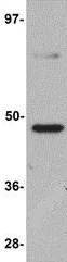 Western blot - Anti-TMEM184C antibody (AB106719)