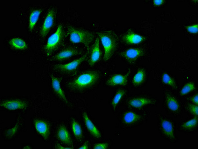 Immunocytochemistry/ Immunofluorescence - Anti-TMEM192 antibody (AB236858), expandable thumbnail