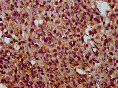 Immunohistochemistry (Formalin/PFA-fixed paraffin-embedded sections) - Anti-TMEM192 antibody (AB236858), expandable thumbnail
