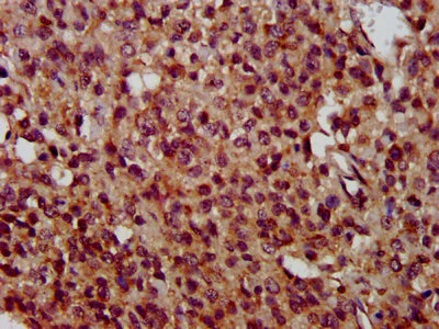 Immunohistochemistry (Formalin/PFA-fixed paraffin-embedded sections) - Anti-TMEM192 antibody (AB236858)