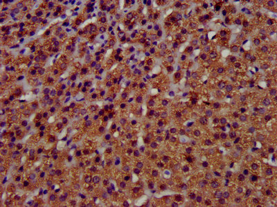 Immunohistochemistry (Formalin/PFA-fixed paraffin-embedded sections) - Anti-TMEM192 antibody (AB236858), expandable thumbnail