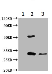 Immunoprecipitation - Anti-TMEM192 antibody (AB236858), expandable thumbnail