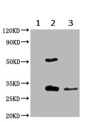 Immunoprecipitation - Anti-TMEM192 antibody (AB236858)