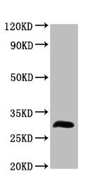 Western blot - Anti-TMEM192 antibody (AB236858), expandable thumbnail