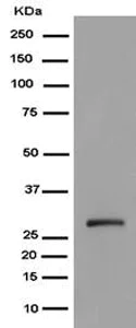 Western blot - Anti-TMEM192 antibody [EPR14330] (AB185545)