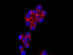 Immunocytochemistry/ Immunofluorescence - Anti-TMEM192 antibody [EPR14330] - BSA and Azide free (AB250834)