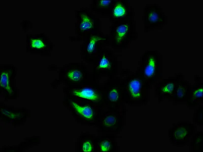 Immunocytochemistry/ Immunofluorescence - Anti-TMEM2 antibody (AB238740)