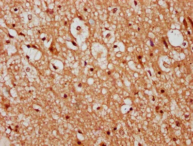 Immunohistochemistry (Formalin/PFA-fixed paraffin-embedded sections) - Anti-TMEM2 antibody (AB238740)