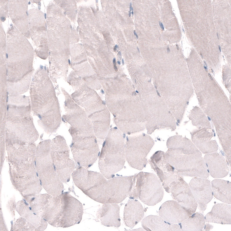 Immunohistochemistry (Formalin/PFA-fixed paraffin-embedded sections) - Anti-TMEM2 antibody (AB272644)