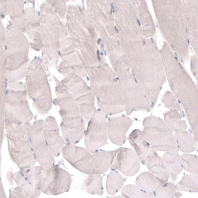 Immunohistochemistry (Formalin/PFA-fixed paraffin-embedded sections) - Anti-TMEM2 antibody (AB272644)