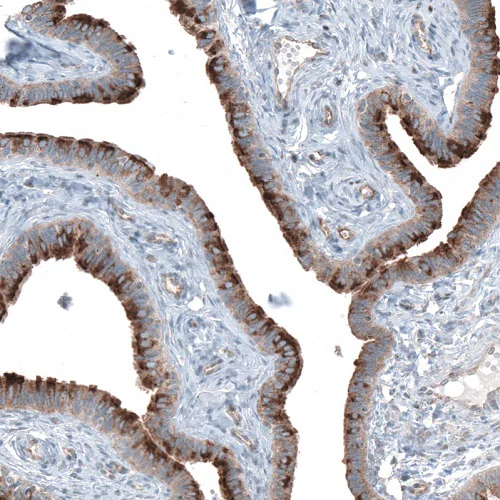 Immunohistochemistry (Formalin/PFA-fixed paraffin-embedded sections) - Anti-TMEM2 antibody (AB272644)