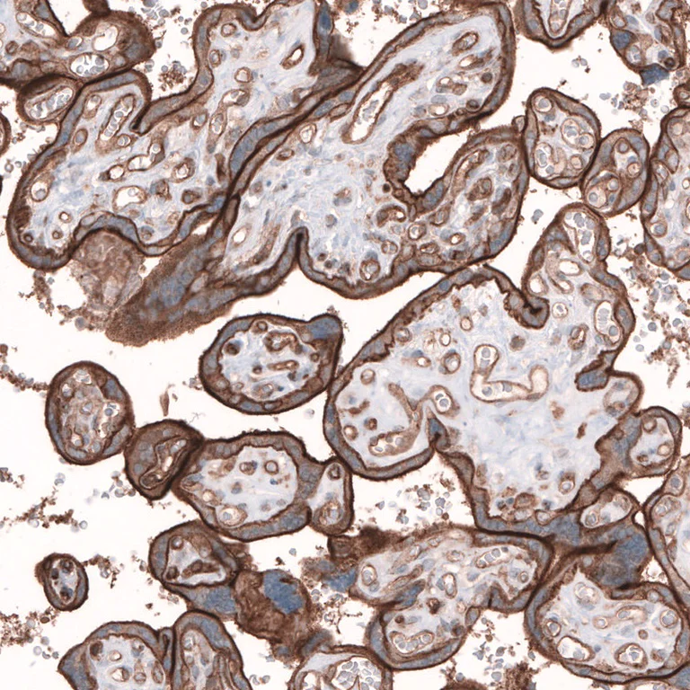 Immunohistochemistry (Formalin/PFA-fixed paraffin-embedded sections) - Anti-TMEM2 antibody (AB272644)