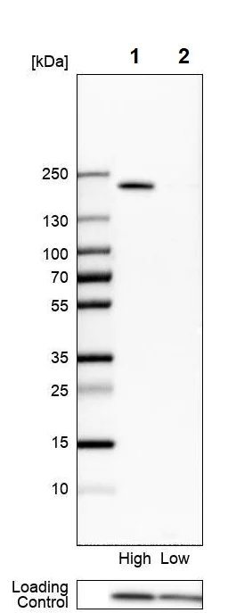 Western blot - Anti-TMEM2 antibody (AB272644)