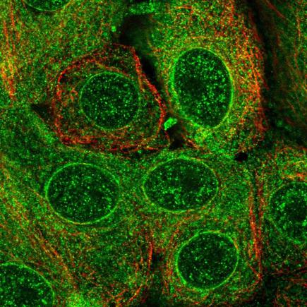 Immunocytochemistry/ Immunofluorescence - Anti-TMEM205 antibody (AB224516), expandable thumbnail
