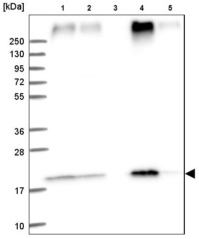 Western blot - Anti-TMEM205 antibody (AB224516), expandable thumbnail