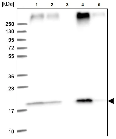 Western blot - Anti-TMEM205 antibody (AB224516)