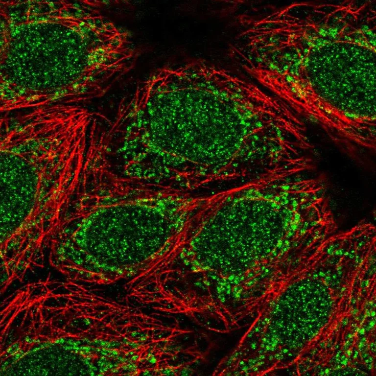 Immunocytochemistry/ Immunofluorescence - Anti-TMEM223 antibody (AB121434)