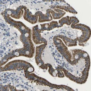 Immunohistochemistry (Formalin/PFA-fixed paraffin-embedded sections) - Anti-TMEM223 antibody (AB121434)