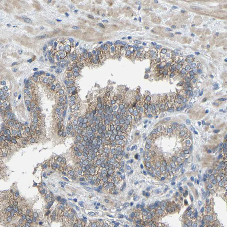 Immunohistochemistry (Formalin/PFA-fixed paraffin-embedded sections) - Anti-TMEM25 antibody (AB121362)