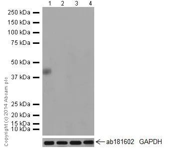 Western blot - Anti-Tmem27 antibody [EPR17748] (AB200664)