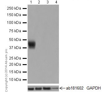 Western blot - Anti-Tmem27 antibody [EPR17748] (AB200664)