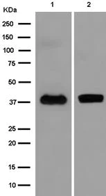 Western blot - Anti-TMEM30B antibody [EPR14409] (AB185944)