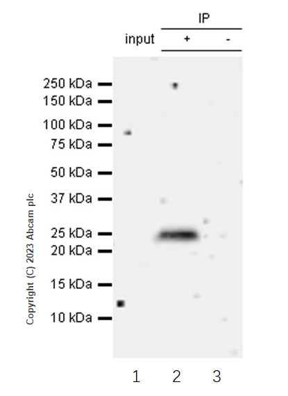 Immunoprecipitation - Anti-TMEM41B antibody [EPR28149-41] (AB314763), expandable thumbnail