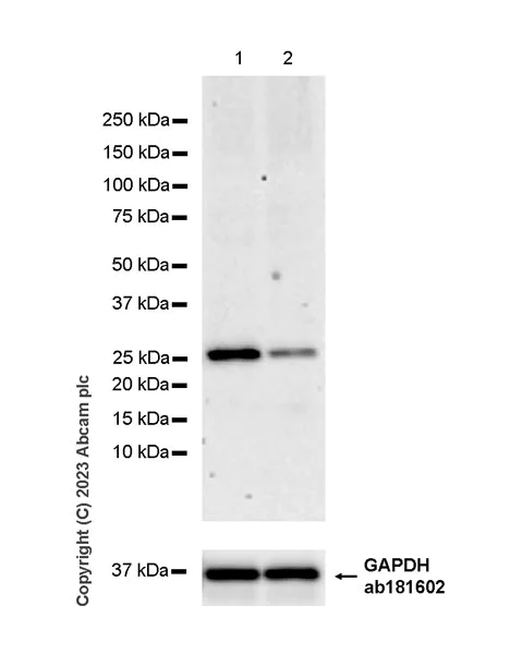 Western blot - Anti-TMEM41B antibody [EPR28149-41] - BSA and Azide free (AB314764)