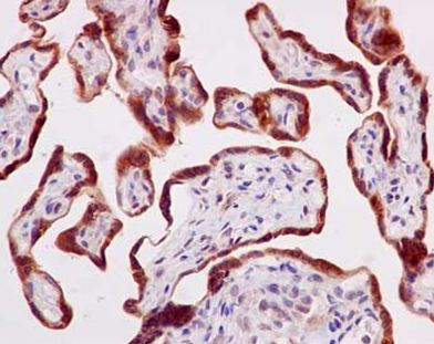 Immunohistochemistry (Formalin/PFA-fixed paraffin-embedded sections) - Anti-TMEM43 antibody [EPR15378(B)] - BSA and Azide free (AB250723), expandable thumbnail