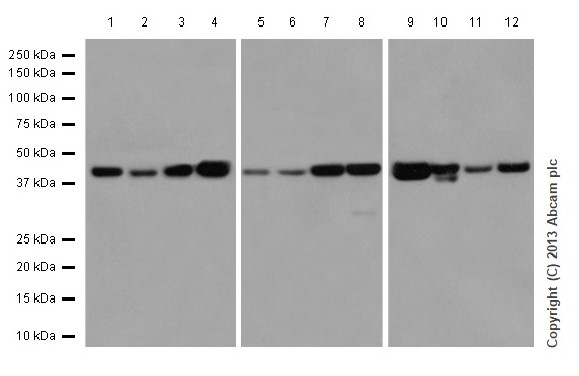 Western blot - Anti-TMEM43 antibody [EPR15378(B)] - BSA and Azide free (AB250723), expandable thumbnail