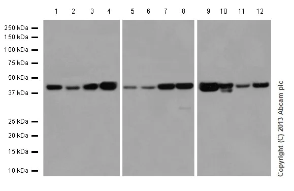 Western blot - Anti-TMEM43 antibody [EPR15378(B)] - BSA and Azide free (AB250723)