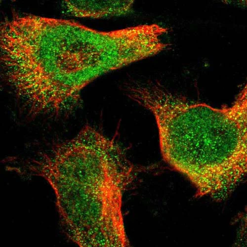 Immunocytochemistry/ Immunofluorescence - Anti-TMEM45B antibody (AB121488)