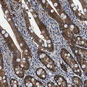 Immunohistochemistry (Formalin/PFA-fixed paraffin-embedded sections) - Anti-TMEM45B antibody (AB121488)