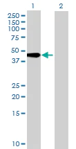 Western blot - Anti-TMEM49/VMP1 antibody (AB69224)
