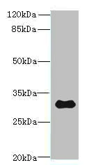 Western blot - Anti-TMEM53 antibody (AB236854)