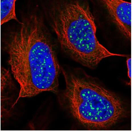 Immunocytochemistry/ Immunofluorescence - Anti-TMEM56 antibody - C-terminal (AB188442)