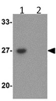 Western blot - Anti-TMEM59 antibody (AB105417), expandable thumbnail