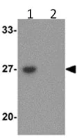 Western blot - Anti-TMEM59 antibody (AB105417)