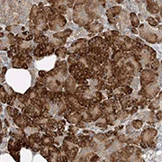 Immunohistochemistry (Formalin/PFA-fixed paraffin-embedded sections) - Anti-TMEM61 antibody (AB122117)