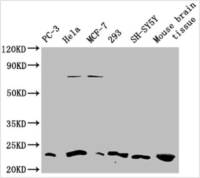 Western blot - Anti-TMEM65 antibody (AB236861)