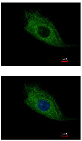 Immunocytochemistry/ Immunofluorescence - Anti-TMEM66/SARAF antibody (AB154538), expandable thumbnail