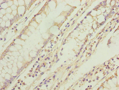 Immunohistochemistry (Formalin/PFA-fixed paraffin-embedded sections) - Anti-TMEM71 antibody (AB235788)