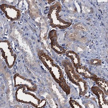 Immunohistochemistry (Formalin/PFA-fixed paraffin-embedded sections) - Anti-TMEM72 antibody (AB122598)