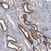 Immunohistochemistry (Formalin/PFA-fixed paraffin-embedded sections) - Anti-TMEM72 antibody (AB122598)