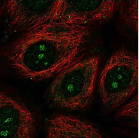 Immunocytochemistry/ Immunofluorescence - Anti-TMEM79 antibody - N-terminal (AB185453)