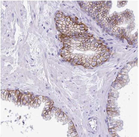 Immunohistochemistry (Formalin/PFA-fixed paraffin-embedded sections) - Anti-TMEM79 antibody - N-terminal (AB185453)